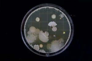 bactéries dans un bassin de jardin